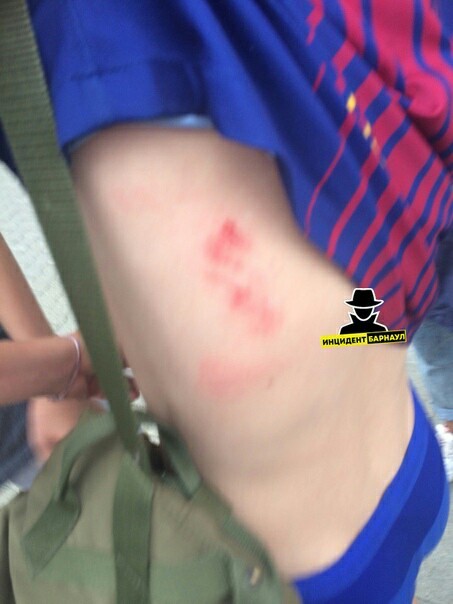 Ветеринар побила подростка за "испорченный" рекламный баннер. Избиение, Подростки, Барнаул, Ветеринар, Видео, Длиннопост