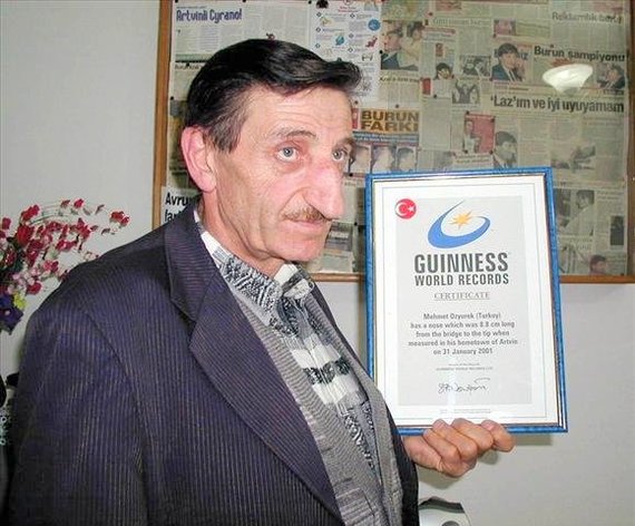 The man with the biggest nose. - The largest in the world, Nose, Guinness Book of Records, , Turks