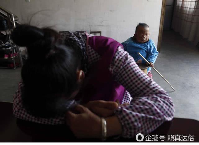 31-year-old Chinese man trapped in the body of a 4-year-old child - Children, China, Ugliness, A son, Unusual, Longpost