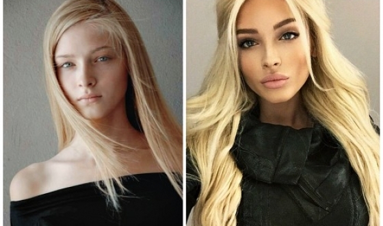 Before and after plastic surgery - Stars, Plastic surgery, It Was-It Was, Longpost, Stars