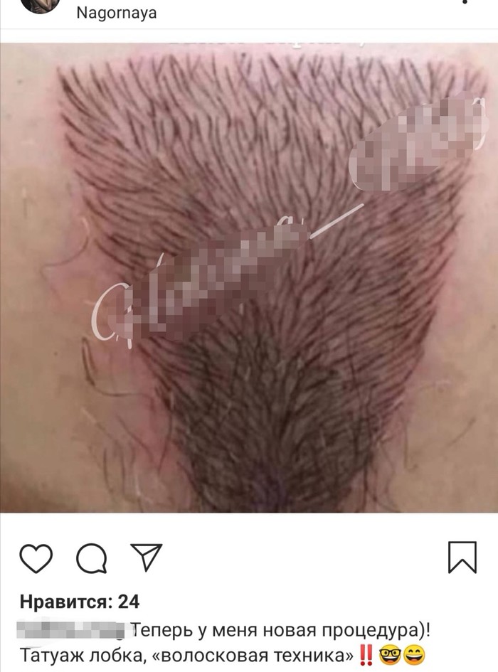 What progress has come ... - NSFW, 18+, Tattooing, Epilation