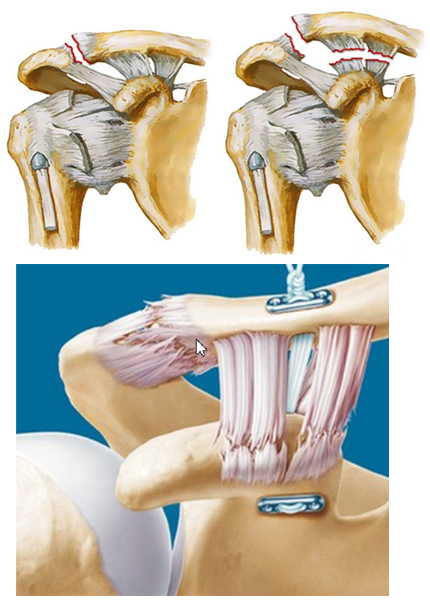 Arthroscopy - My, The medicine, Medicine in Russia, Longpost, Arthroscopy