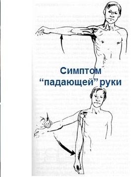 Arthroscopy - My, The medicine, Medicine in Russia, Longpost, Arthroscopy