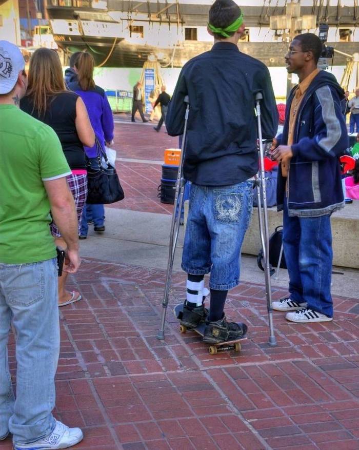 When friends called for a drink - Fracture, Crutches, , Savvy, The photo, Disabled carriage