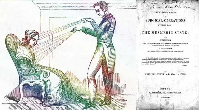 История анестезии: от белены до винишка Медицина, Наука, История, Scientaevulgaris, Длиннопост