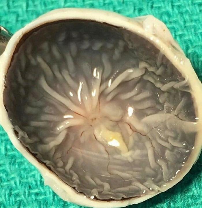 Как выглядит глаз с другой стороны