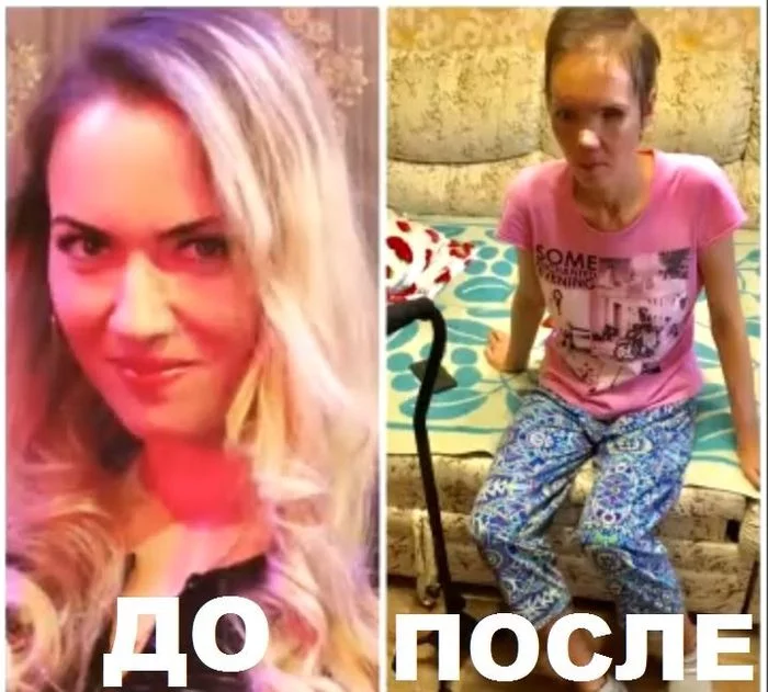Before and after... - Ulyanovsk, Ulyanovsk region, Help, Repost, Translation, Video, Longpost