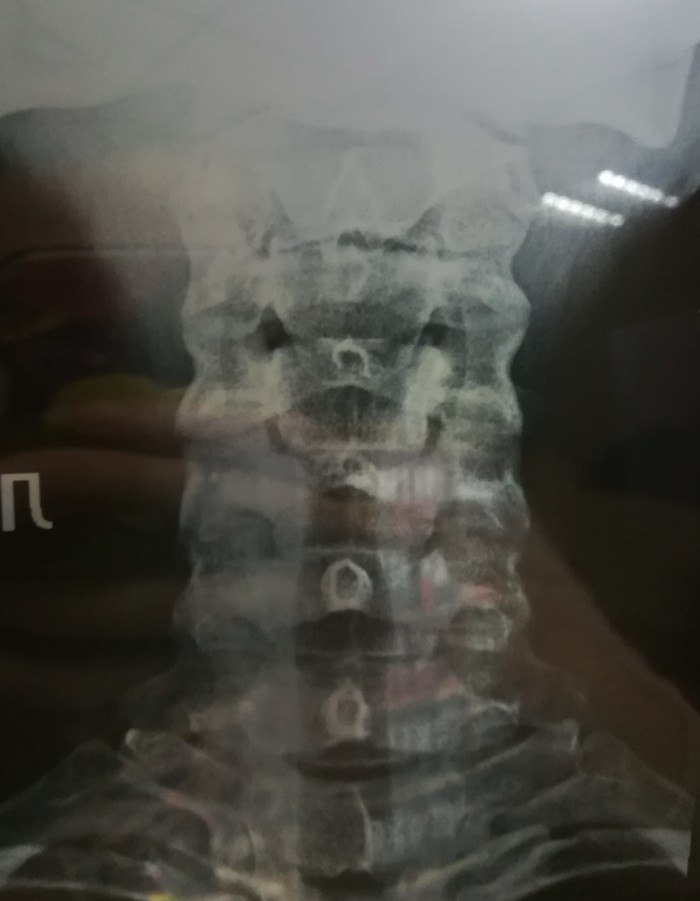 ���������� �����