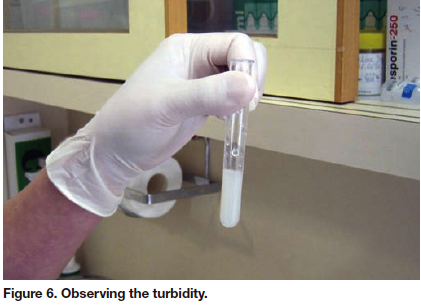 How to do a general urine test - My, Analysis, Medical tests, Laboratory, The medicine, Longpost