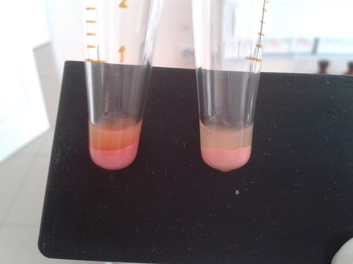 Как делают общий анализ мочи Анализ, Медицинские анализы, Лаборатория, Медицина, Длиннопост