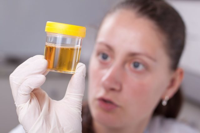 How to do a general urine test - My, Analysis, Medical tests, Laboratory, The medicine, Longpost