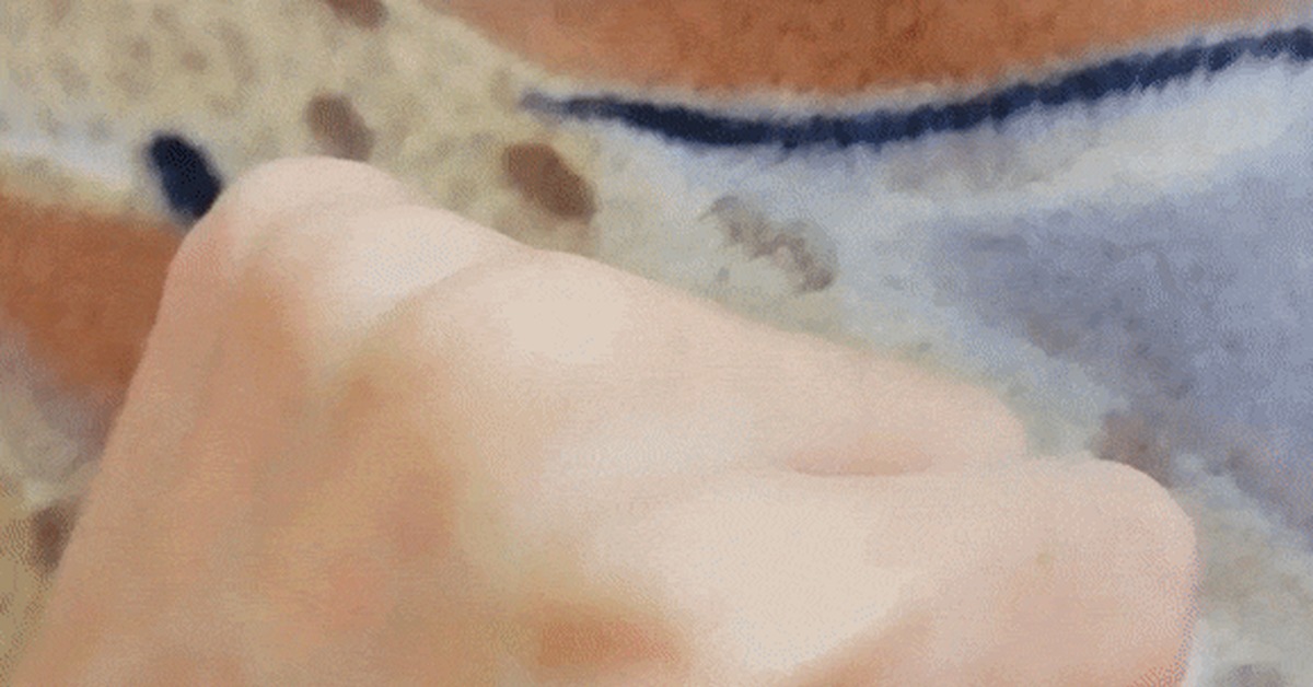 Is my hand okay? - My, Hand, Tendon, Oddities, GIF