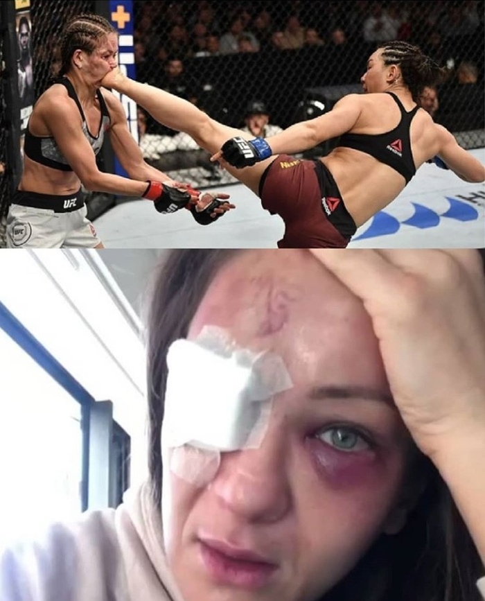       ,      , MMA, 