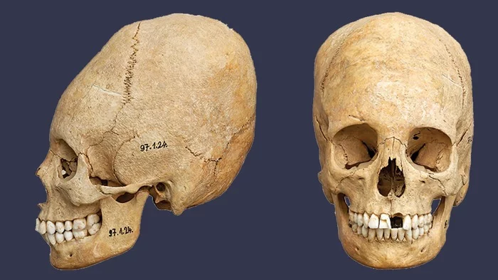 В Венгрии нашли кладбище времён Римской империи. Почему черепа такие длинные? - Археология, Находка, Римляне, Гунны, Венгрия, Ассимиляция, История, Античность, Длиннопост