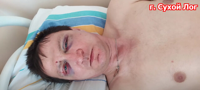 Unknown people beat up the famous activist Igor Ufimtsev, who opposes the construction of a GARBAGE LANDFILL! - Negative, news, Bandits, Ural, Yekaterinburg, Polygon, Garbage, Ecology, Video