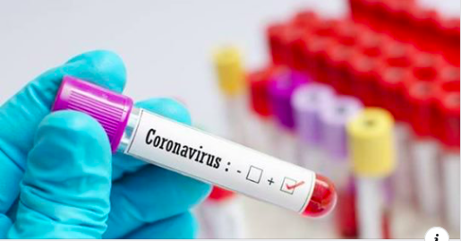 The KhZ regime today has changed to START and IBD - My, Coronavirus, Self-isolation