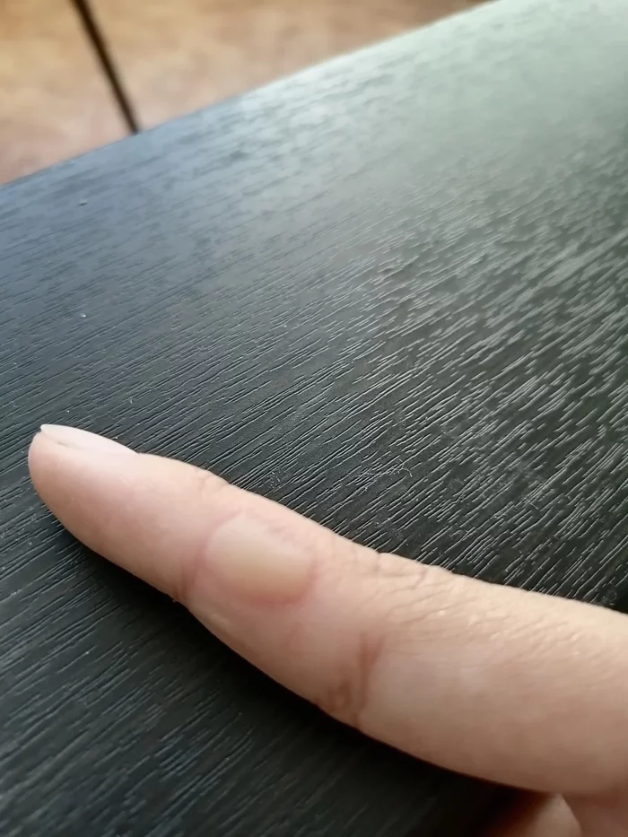 Bit my finger - My, Fingers, Bite