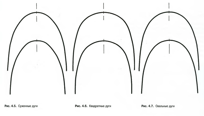 Как работают брекеты? | Пикабу