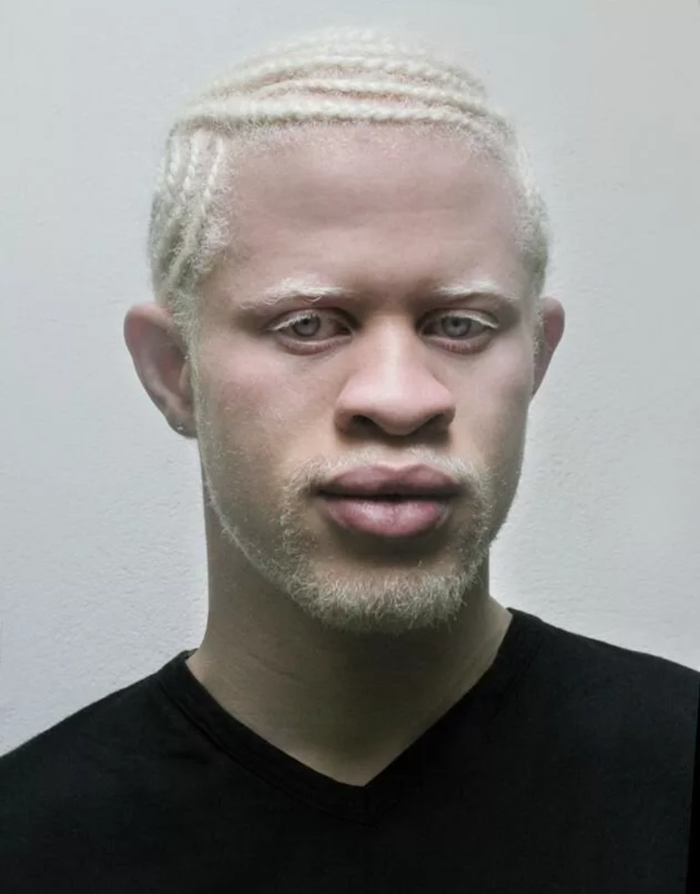 Blacks feels better!!!