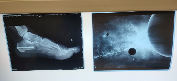 Когда работаешь Рентгенологом, но в душе Космонавт