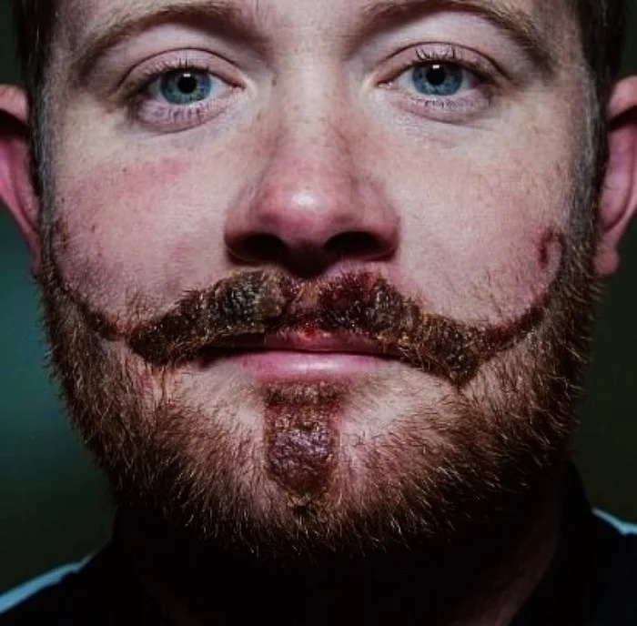 How a henna tattoo ruined a Briton's face - Henna, Guy Fawkes, Tattoo, Competition, Усы, Beard, Skin grafting, Longpost