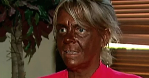The woman supported Black Lives Matter and will now remain black - Black lives matter, Cream, Blackface, Self-tanning, Humor, Fake news