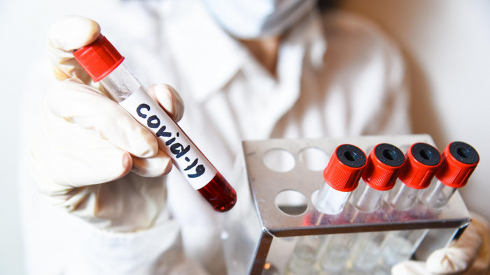  : OpenPandemics - COVID-19 , ,  , , 