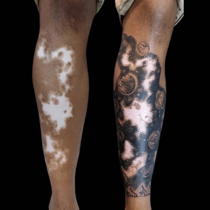 Cover up vitiligo with a tattoo! - Legs, Vitiligo, Tattoo, Оригинально, Space, Planet, It Was-It Was, The photo