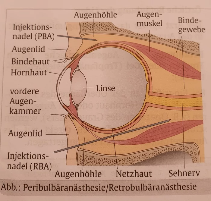 How cataracts are operated on in Germany - My, Disease, Eye surgery, The medicine, Longpost