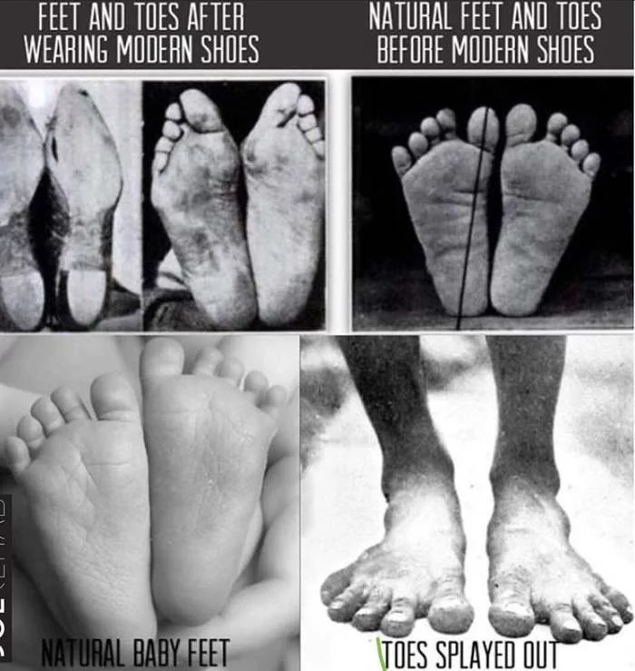 The effect of wearing modern shoes - Shoes, Person, Fingers, Sneakers