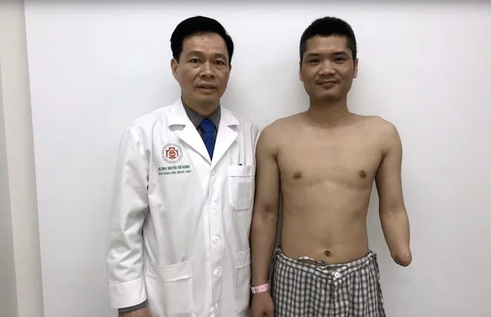 Good news - Surgery, Transplantation, Vietnam, Hand, Operation, Longpost, Asians, Disabled person