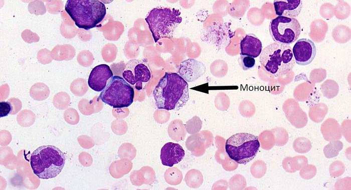 Картинки моноциты под микроскопом