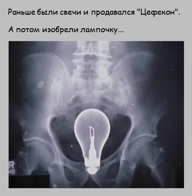 Ilyich's light bulb - Bulb, Booty, Humor, Clinic