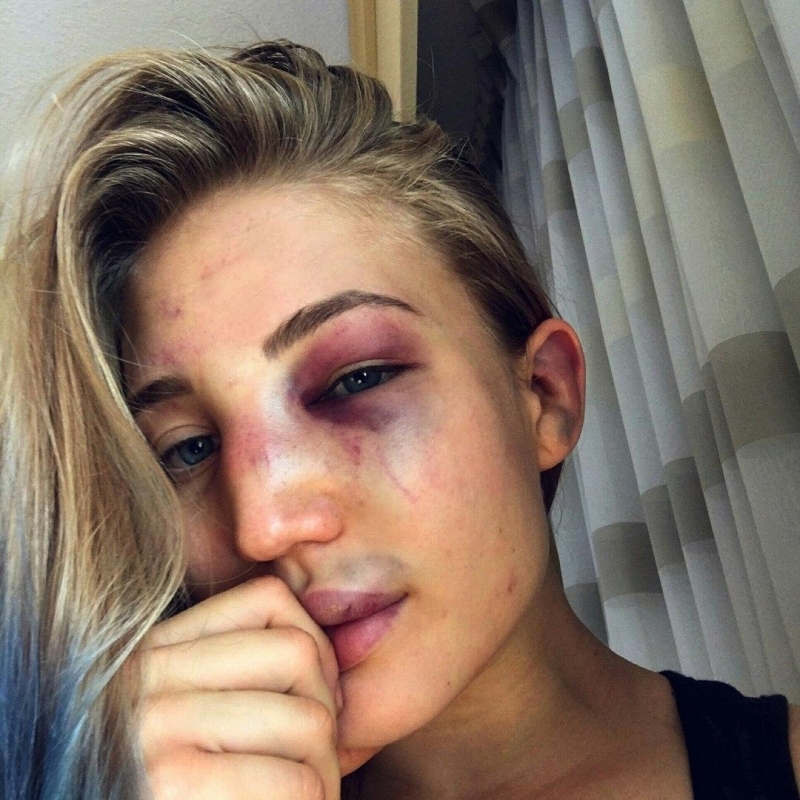 Anastasia Yankova before and after the fight with American Veta Arteaga. - , Boxing, It Was-It Was, Longpost