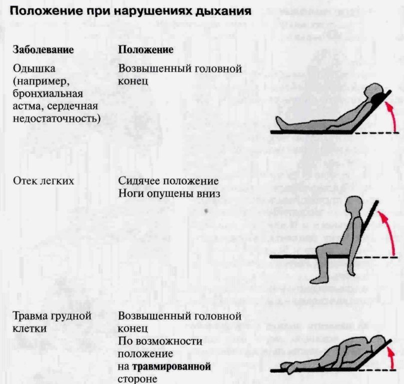 Уход при различных заболеваниях и состояниях. Положение больного при отеке легких. Положение больного. Положение тела больного. Положение пациента сидя.