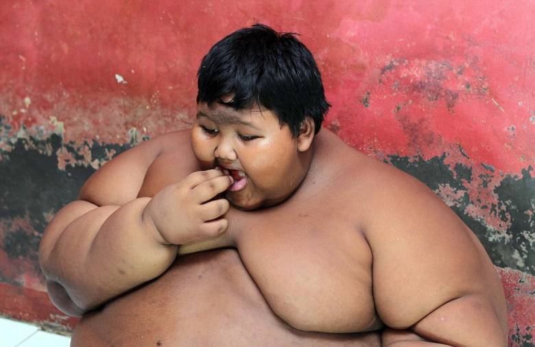 Arya Permana is the fattest child in the world - Events, Society, Health, Peace, Indonesia, Boy, Excess weight, Longpost