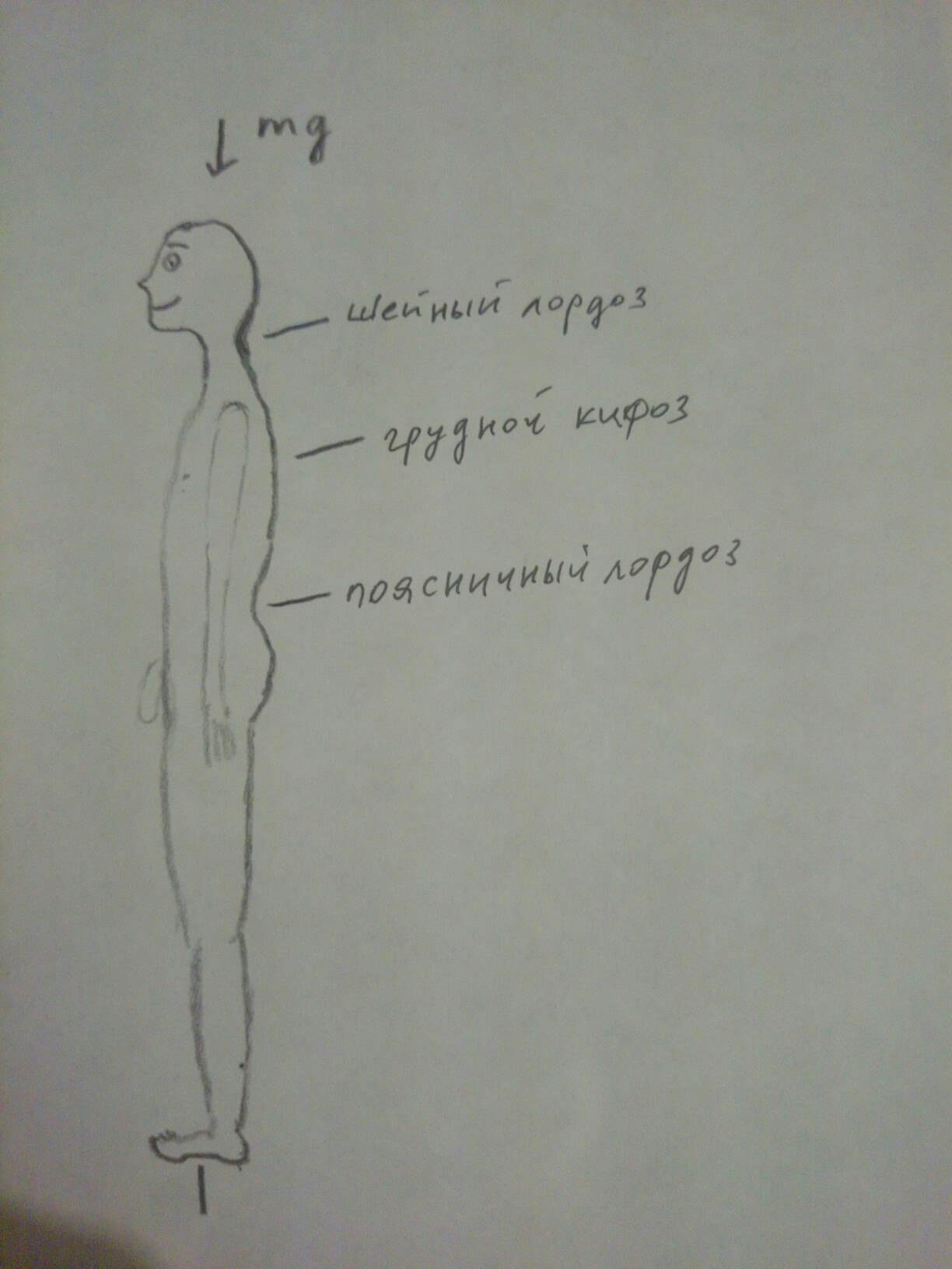 Scoliosis and fitness. part 1 - My, Scoliosis, The medicine, Fitness, Longpost