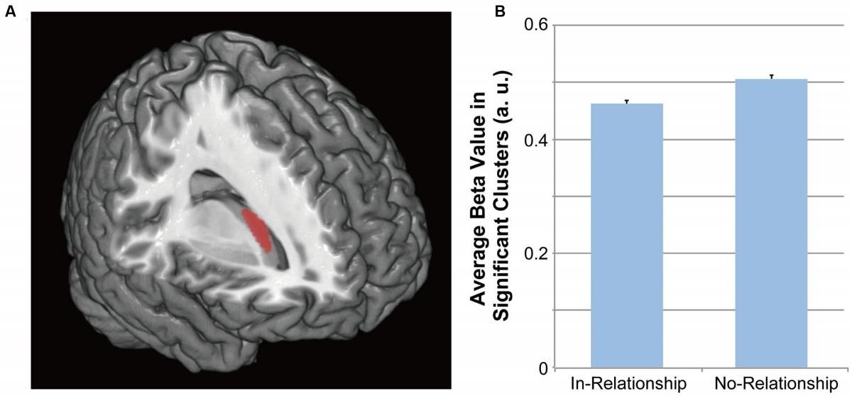 Falling in love is associated with a decrease in the volume of gray matter - Love, Brain, The science, Longpost