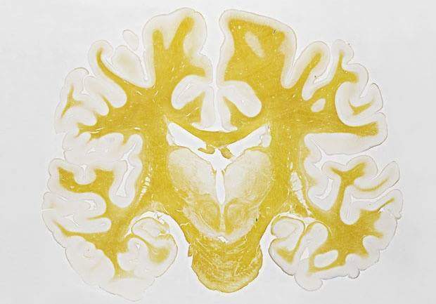 Slice of the brain. The preparation is stained with a dye containing silver, which accumulates in myelin. - In contact with, Microscope