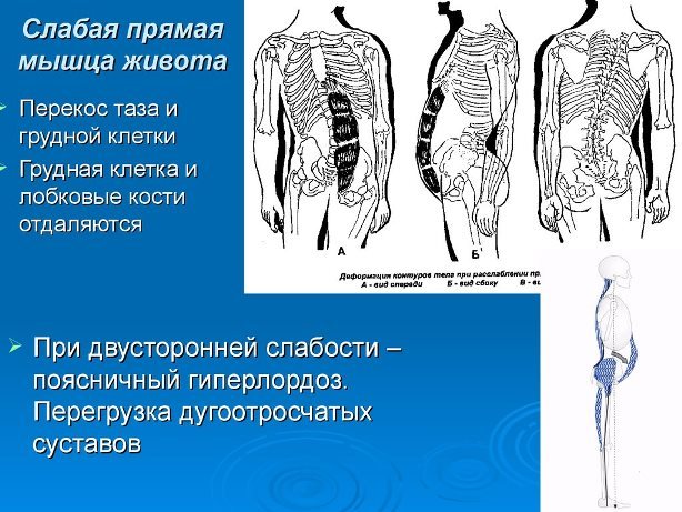 Так ли полезен «вакуум» в животе? (очередной секрет) - Моё, Живот, Вакуум, Пресс, Анатомия, Кубики пресса, Спорт, Тренировка, Длиннопост