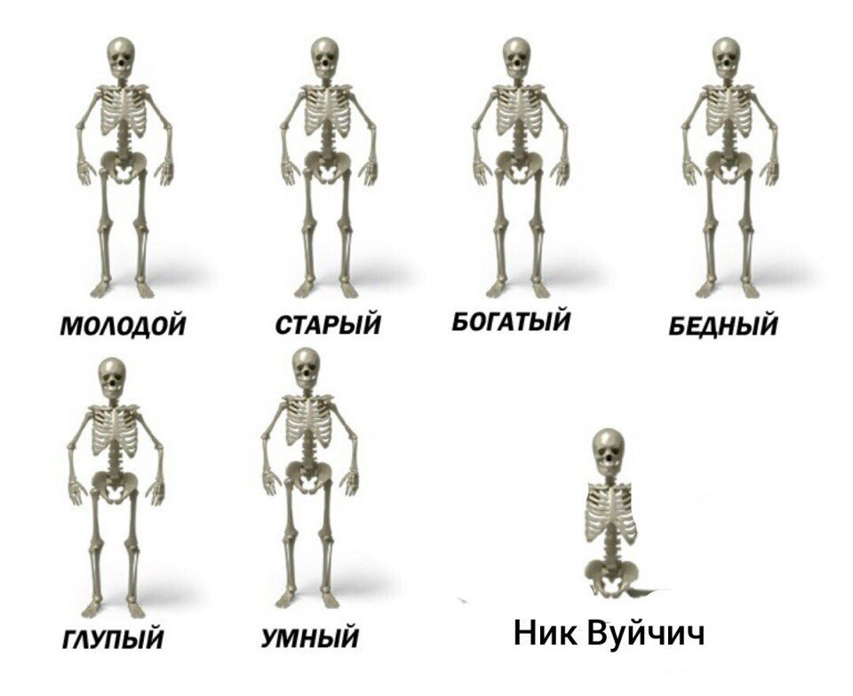Секрет Ника Вуйчича | Пикабу