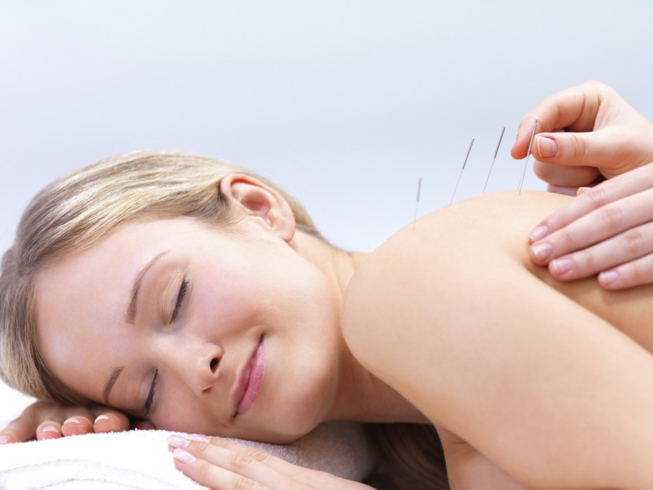 Acupuncture is another scam - Acupuncture, Acupuncture, Pseudoscience, Longpost