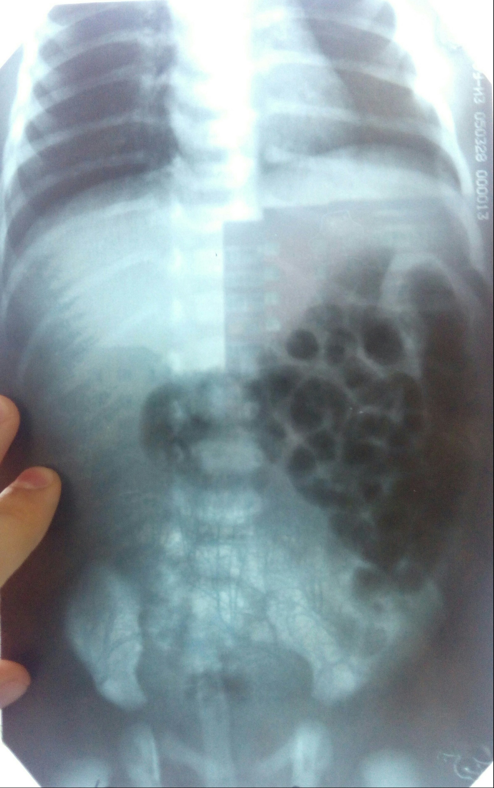 What's in the picture? - My, The medicine, X-ray, The photo