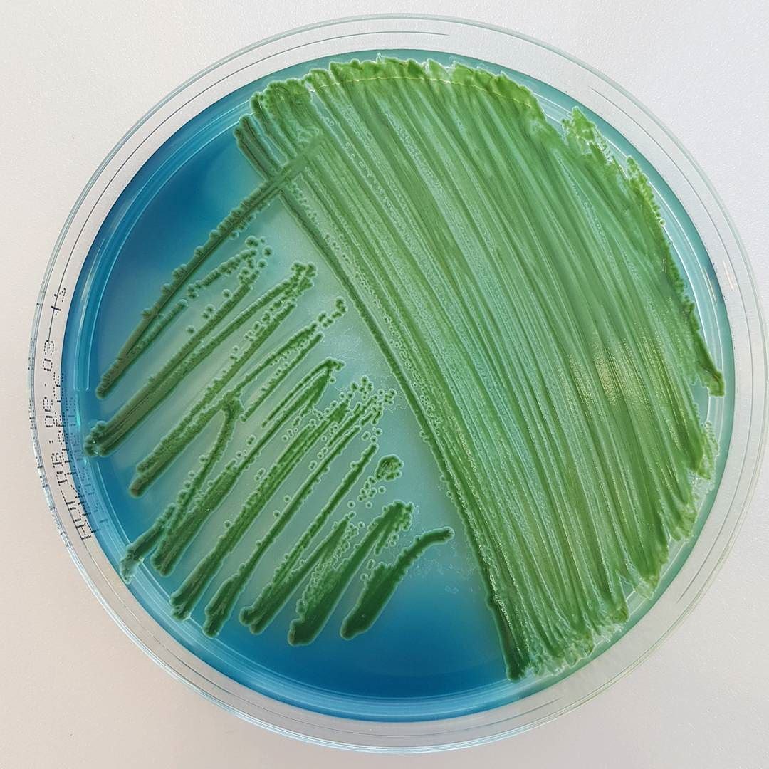 Some cultures of microbacteria - The medicine, Microbiology, Bacteria, Agario, Environment, Images, Longpost