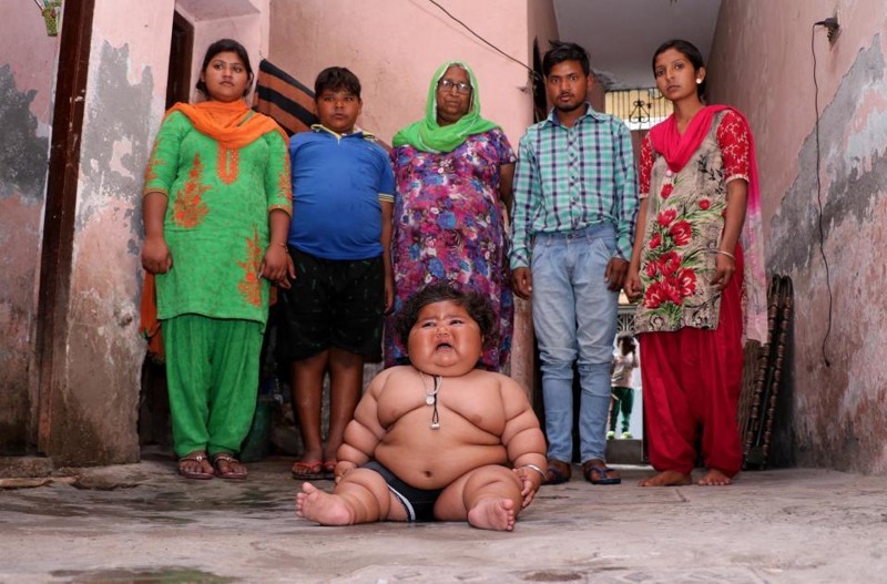 8-month-old girl weighs 17 kilograms, and continues to get fat - Children, Parents, Fatty, Excess weight, Upbringing, India, Girl, Food, Longpost