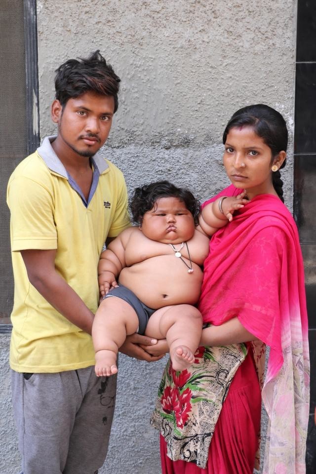 8-month-old girl weighs 17 kilograms, and continues to get fat - Children, Parents, Fatty, Excess weight, Upbringing, India, Girl, Food, Longpost