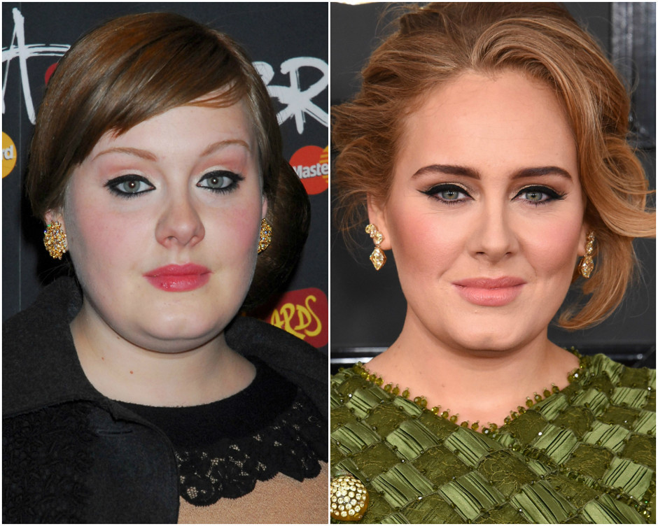 Lumps of Bish: to remove or not - beauty, Plastic surgery, Hollywood, jennifer, Adele, Angelina Jolie, Longpost