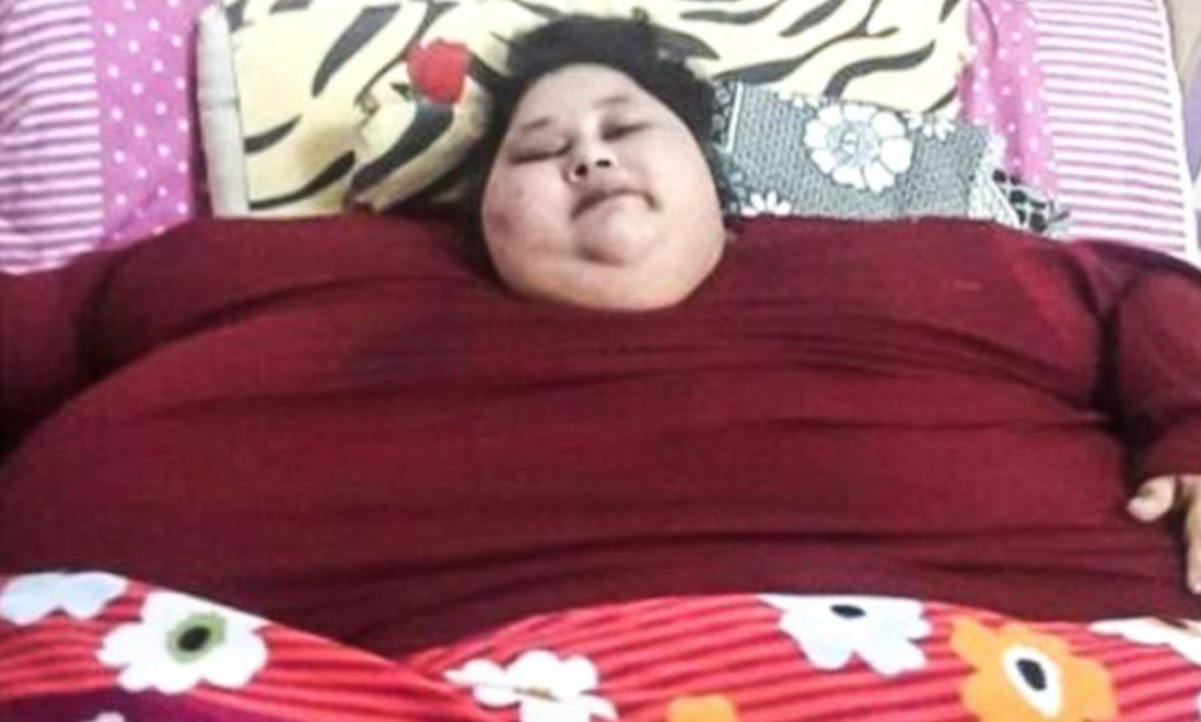 The fattest woman in the world lost 327 kilograms in two months [joke about preparing for the summer] - , Disease, Fullness