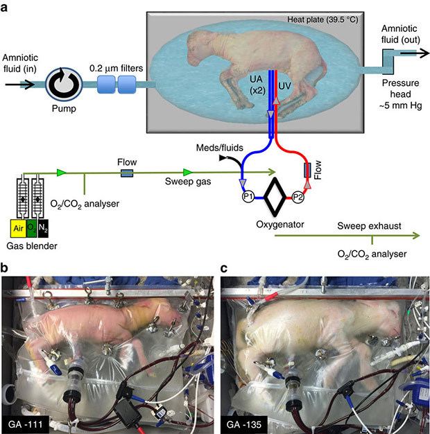 Created an artificial uterus for extremely premature babies. - The medicine, The science, Video, Longpost