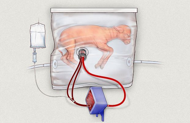 Created an artificial uterus for extremely premature babies. - The medicine, The science, Video, Longpost